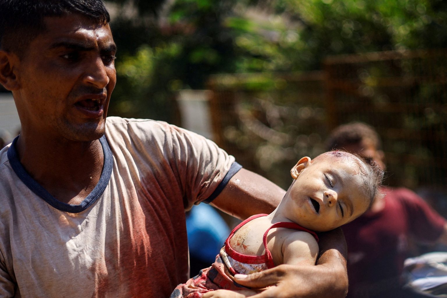 UNICEF: Setidaknya 300 Anak Tewas di Gaza dalam 300 Hari